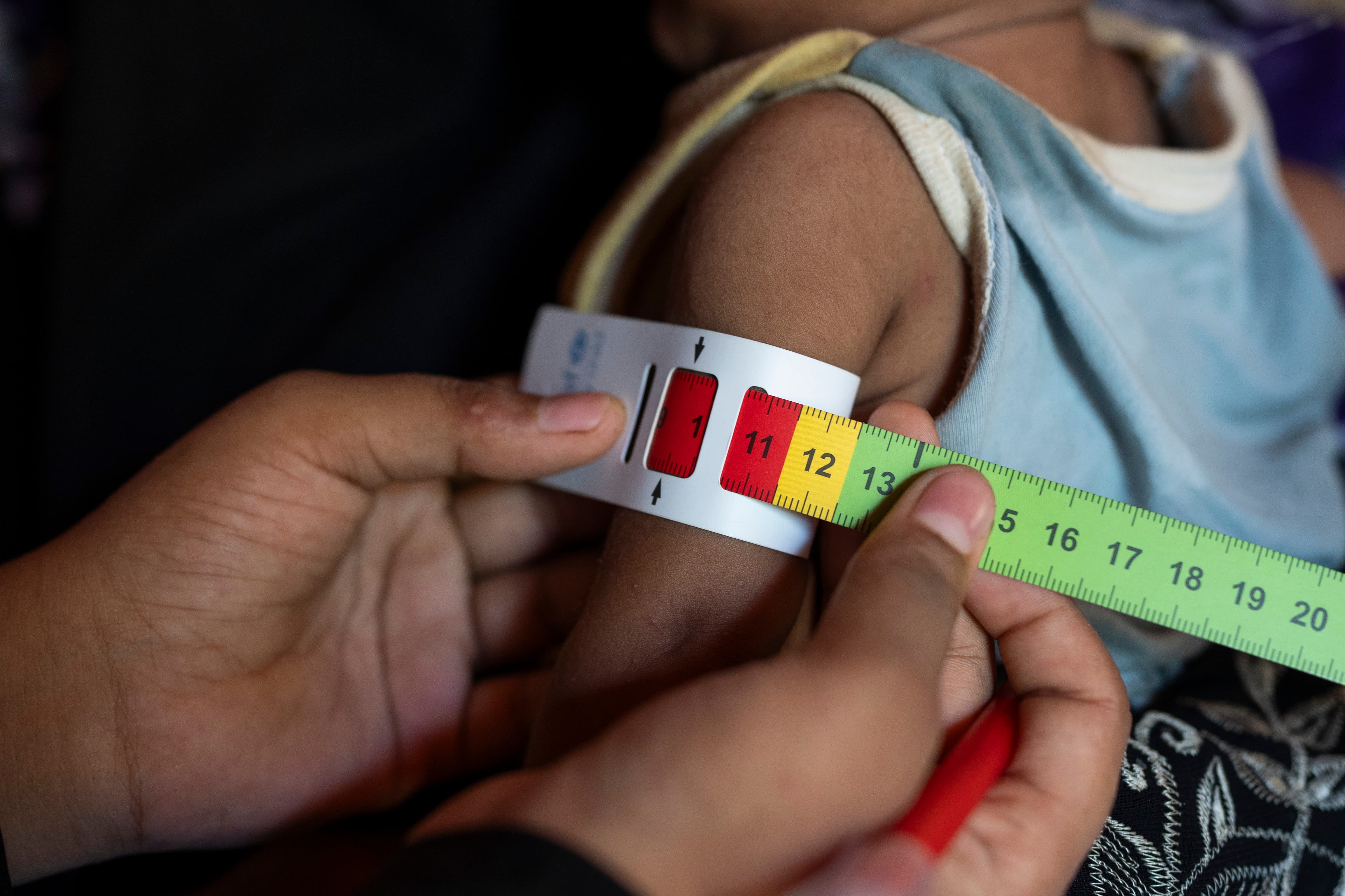 Mother and malnourished child receive nutritional support from Concern Worldwide in Pakistan.