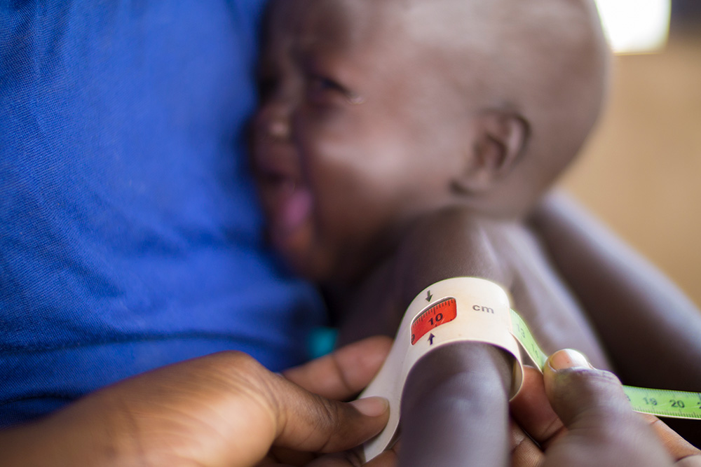 Measuring mid upper arm circumference in South Sudan