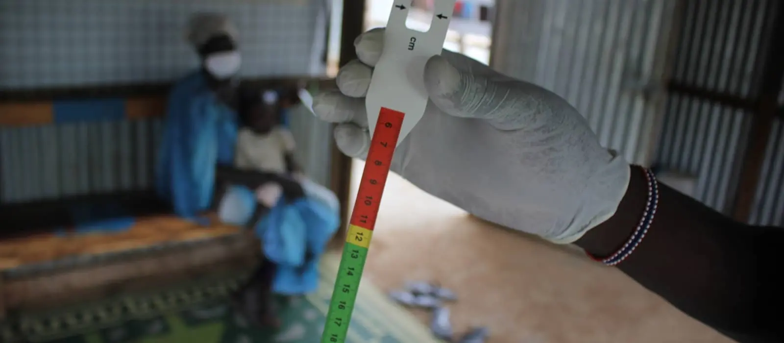 A MUAC band used to assess the nutritional status of children in South Sudan.